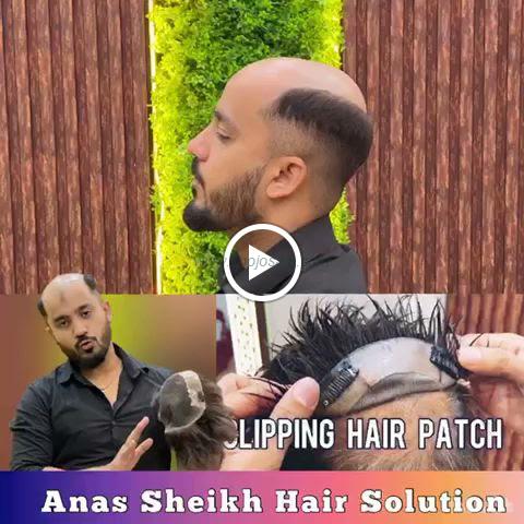 Anas Sheikh Hair Solution