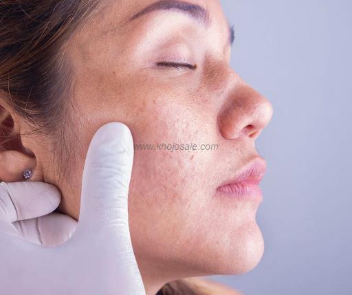 Dr Vipul Gupta Best Dermatologist In Lucknow Best Skin Specialist In Lucknow Hair Specialist In Lucknow
