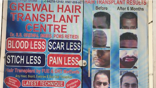 Grewal Hair Transplant Best Hair Transplant Hospital Hair Transplant Specialist Surgeon Stitch Less Transplant Surgeon