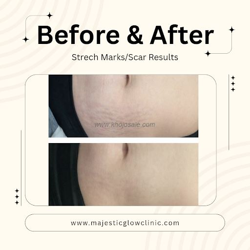 Majestic Glow Skin And Hair Clinic