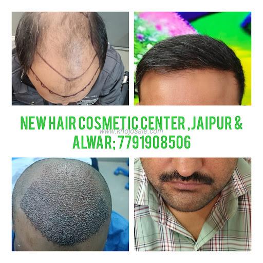 New Hair Cosmetic Centre Alwar Best Hair Transplant In AlwarPrpGfc Best Hair Wigs In Alwar