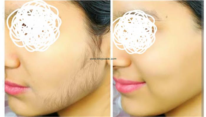 BS Asethetic Clinic, Makeover & Academy