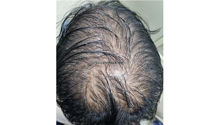 Dr Vipul Gupta - Best Skin & Hair Specialist In Lucknow