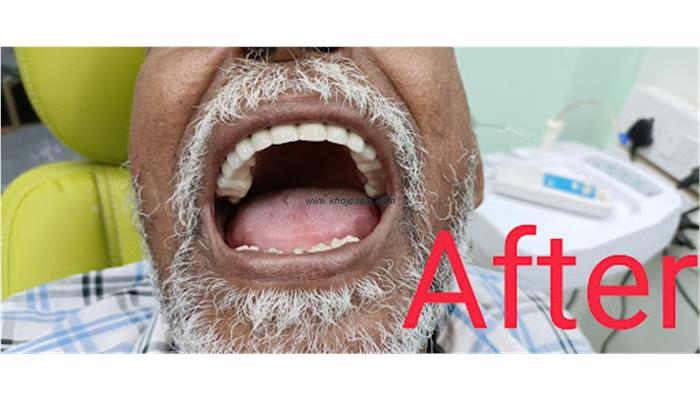 S.K Dental Clinic & Implant Center