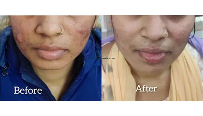 Skin Perfect Clinic (Dr. Gauri Khare)