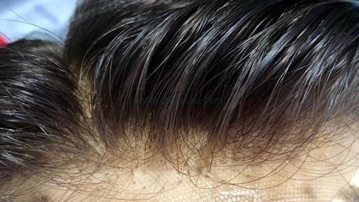 SMART HAIR BEAUTY Hair Weaving Hair Bonding Hair Fixing Hair Wig Hair Patch In Bhopal